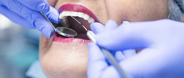 Best Emergency Dentist for Knocked-Out Tooth in Groveland, ID